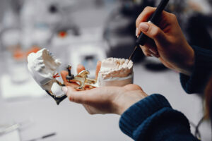 Quanto costa un impianto dentale